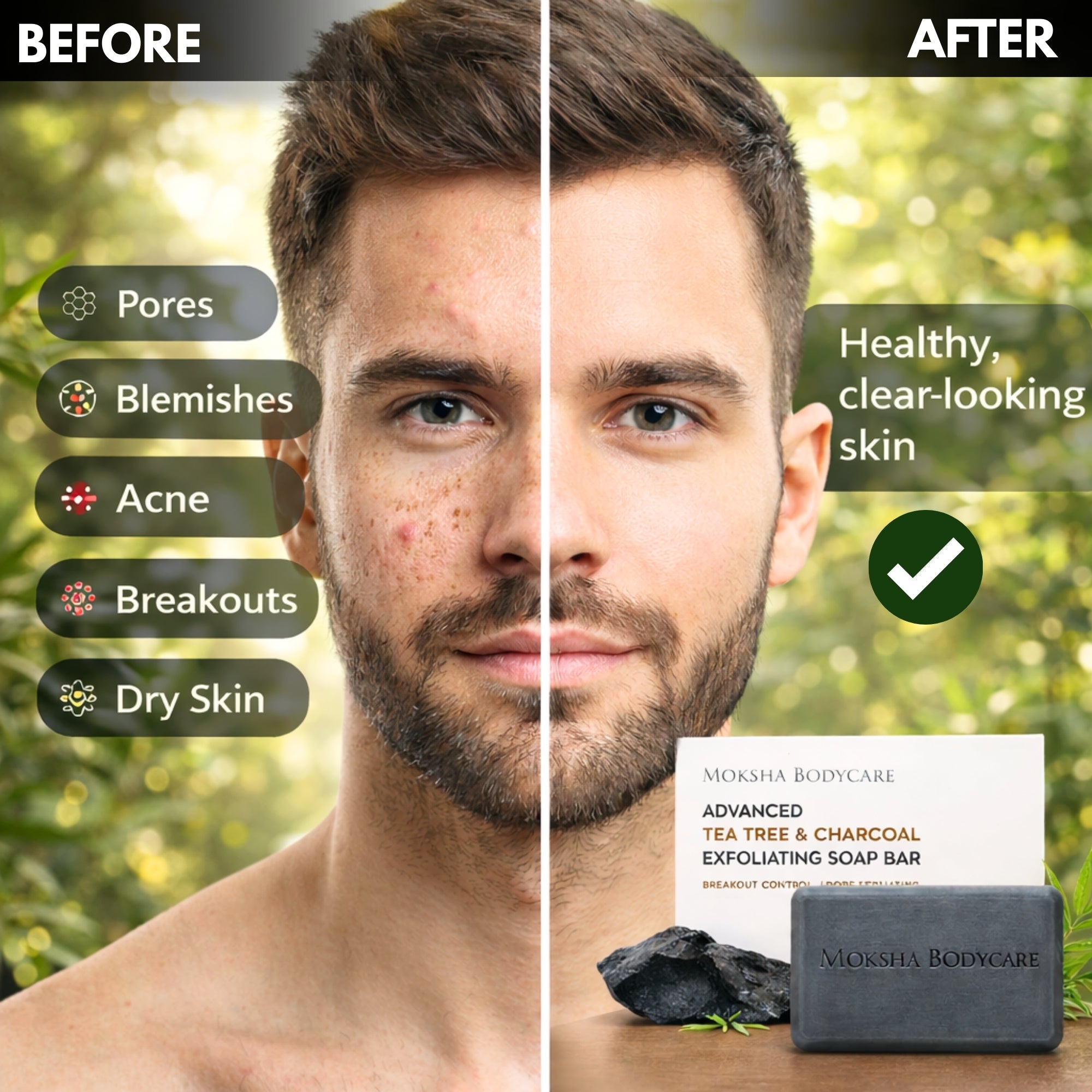 Tea Tree and Charcoal Soap Bar