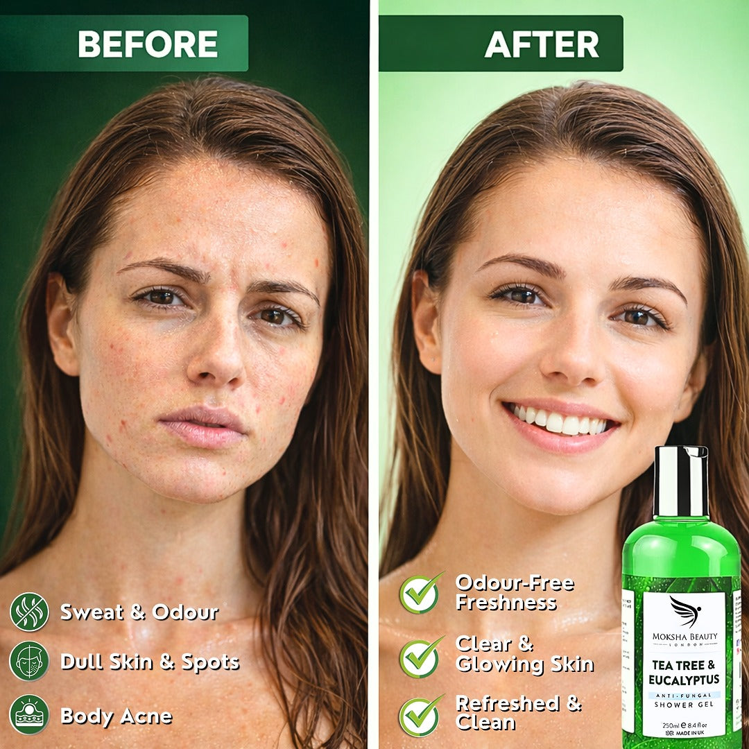 acne face wash for blemishes and breakouts