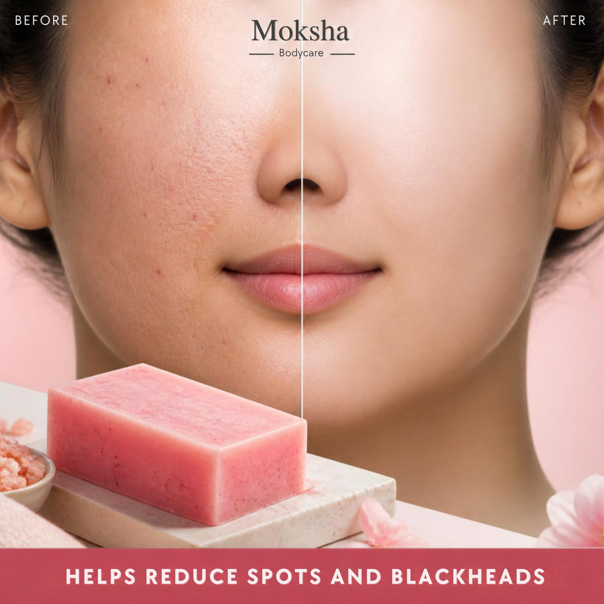 Before and after using salicylic acid and sulphur soap: helps reduce spots and blackheads